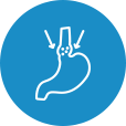 Oesophageal Dilation